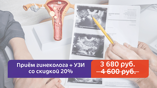 Приём гинеколога + УЗИ за 3 680 руб.